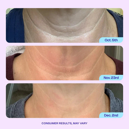 Miracle Neck Cream