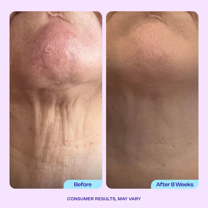 Miracle Neck Cream