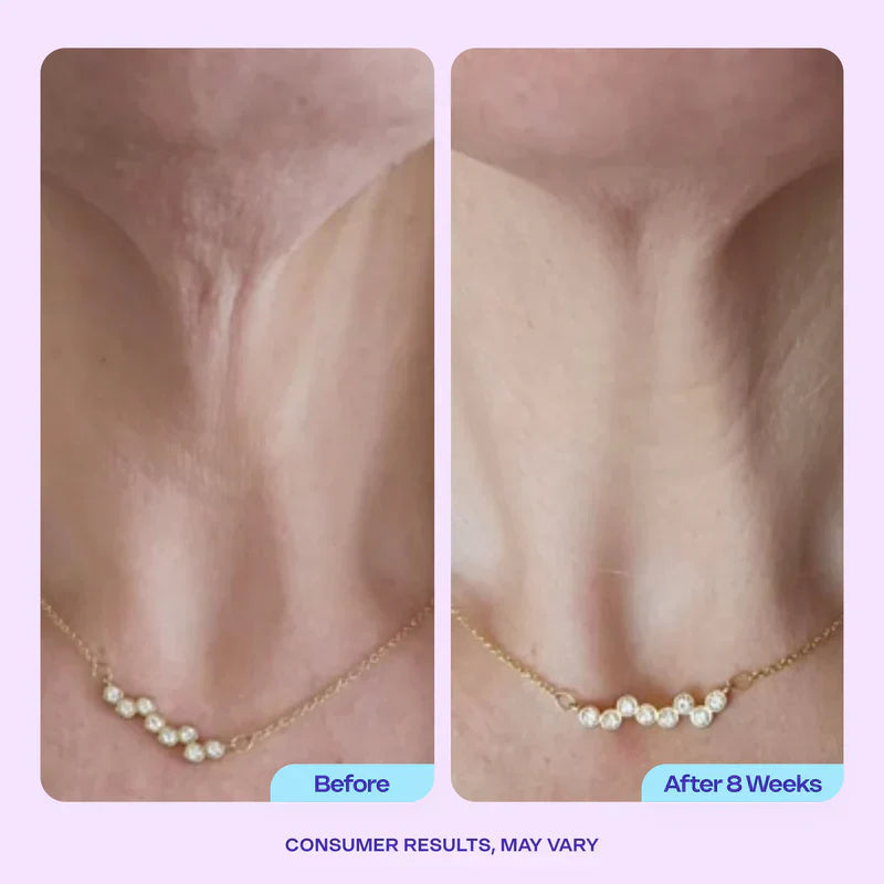 Miracle Neck Cream
